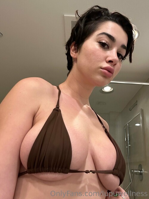 Liz | Lupuwellness Nude Leaked Onlyfans Photo
