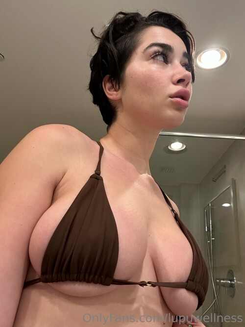 Liz | Lupuwellness Nude Leaked Onlyfans Photo