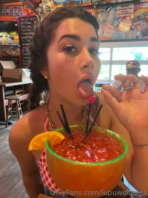 Liz | Lupuwellness Nude Leaked Onlyfans Photo