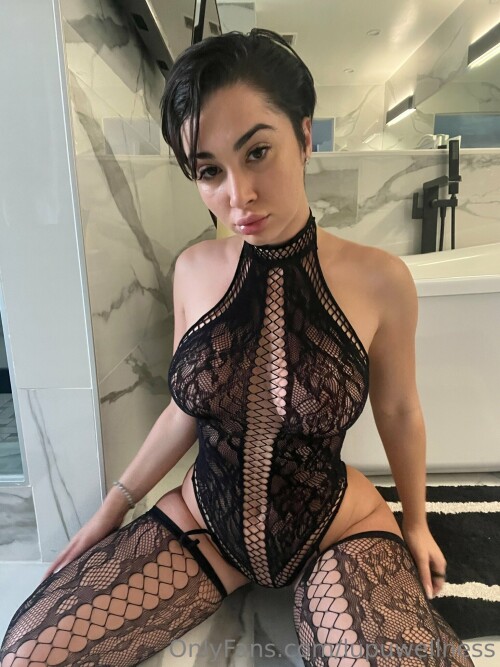 Liz | Lupuwellness Nude Leaked Onlyfans Photo