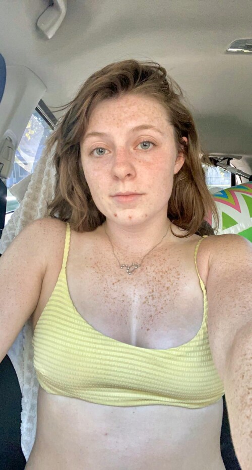 Freckledspirit / Creepyspookygirl / Freakysweetgirl / creepyt0es Nude Leaked Onlyfans Photo Freckledspirit / Creepyspookygirl / Freakysweetgirl / creepyt0es Nude Leaked Onlyfans Photo