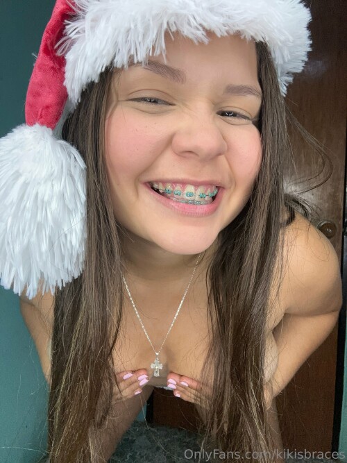 kikisbraces Nude Leaked Onlyfans Photo kikisbraces Nude Leaked Onlyfans Photo