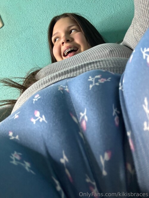 kikisbraces Nude Leaked Onlyfans Photo kikisbraces Nude Leaked Onlyfans Photo