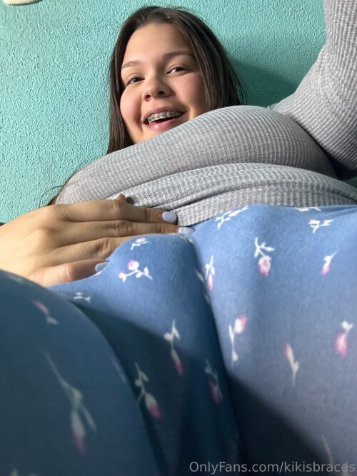 kikisbraces Nude Leaked Onlyfans Photo kikisbraces Nude Leaked Onlyfans Photo