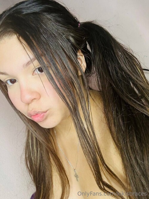 kikisbraces Nude Leaked Onlyfans Photo kikisbraces Nude Leaked Onlyfans Photo