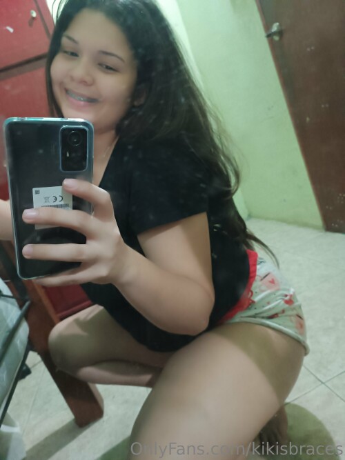 kikisbraces Nude Leaked Onlyfans Photo kikisbraces Nude Leaked Onlyfans Photo